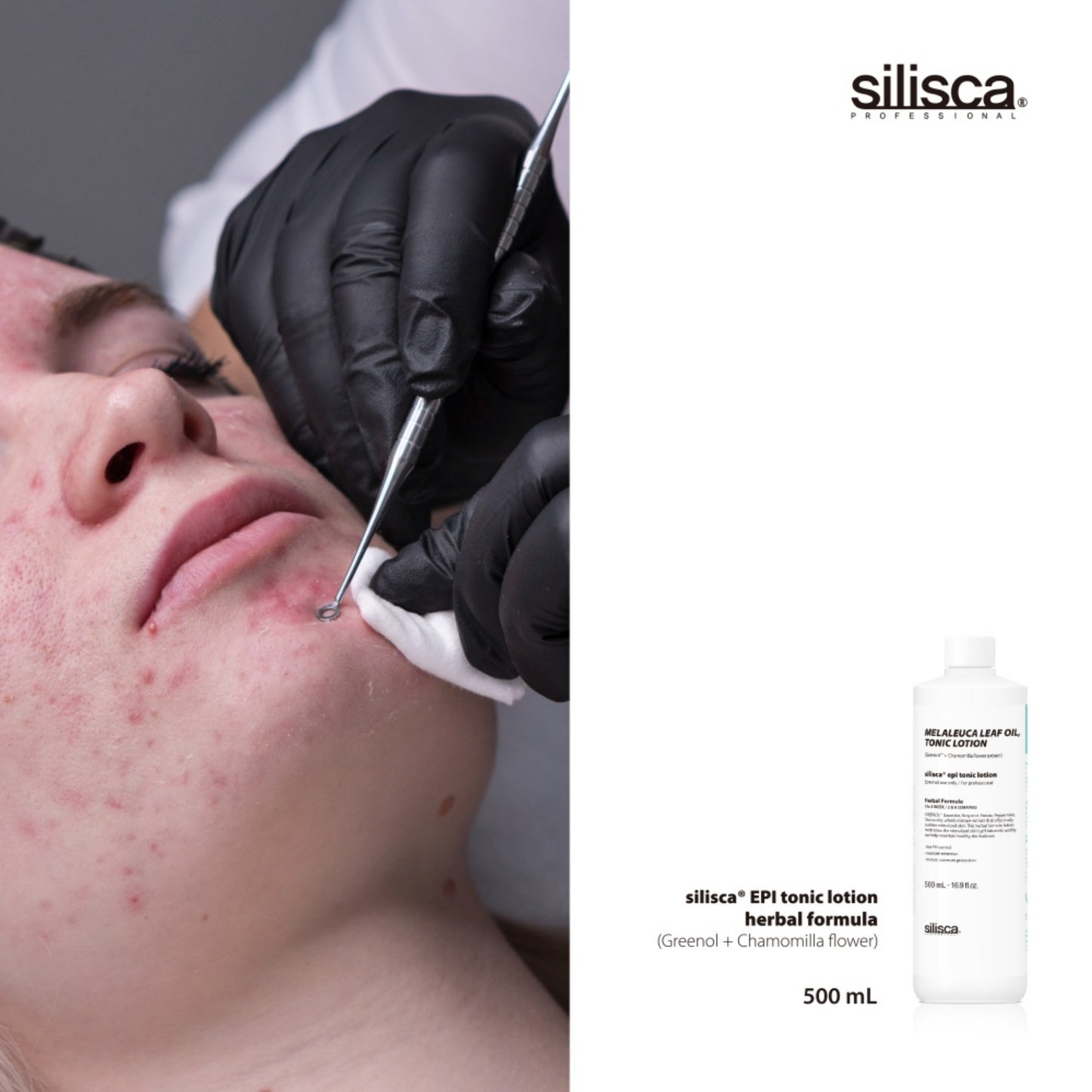 Silisca® EPI Tonic Lotion Herbal Formula